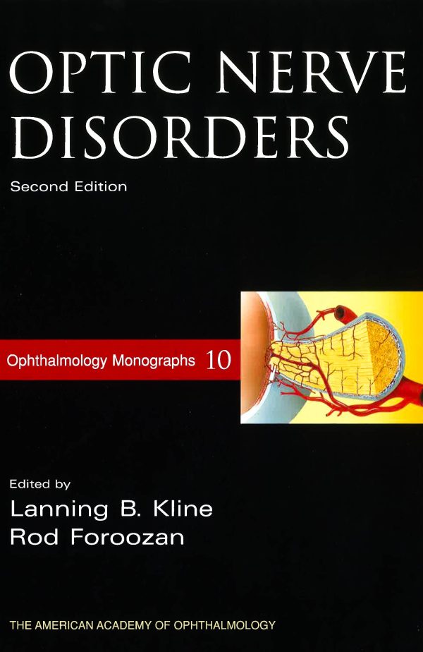 Optic Nerve Disorders For Discount